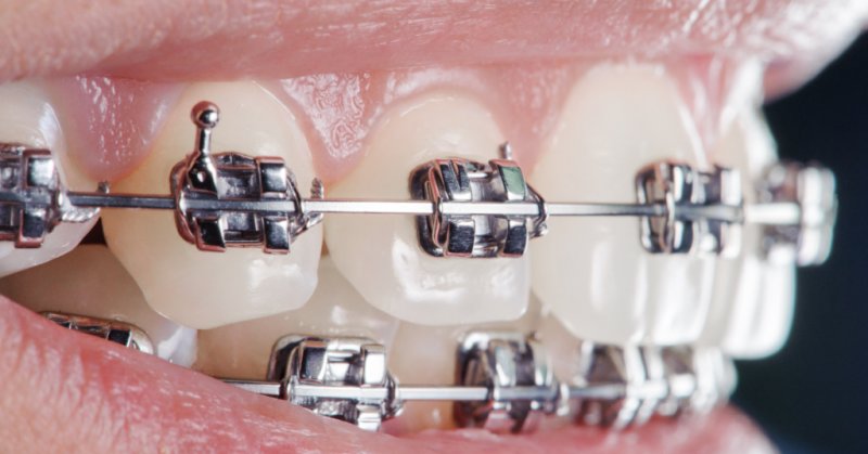 Orthodontics
