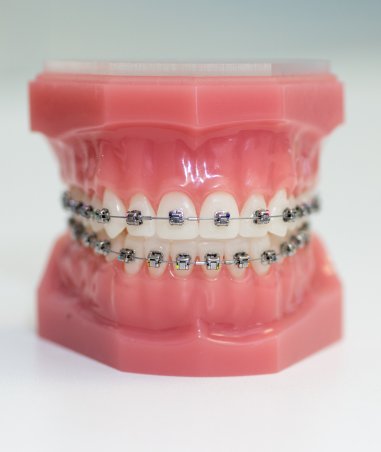 Orthodontics